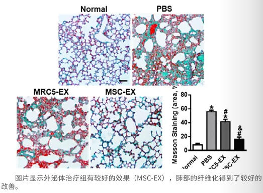 种防治肺损伤的干细胞来源的外泌体制剂